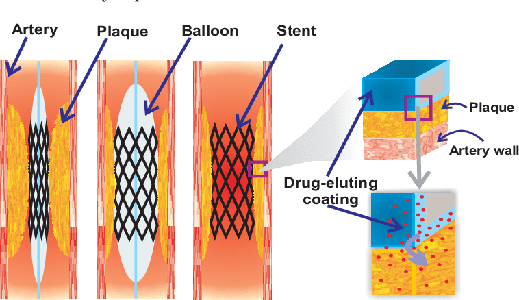 圖片關(guān)鍵詞